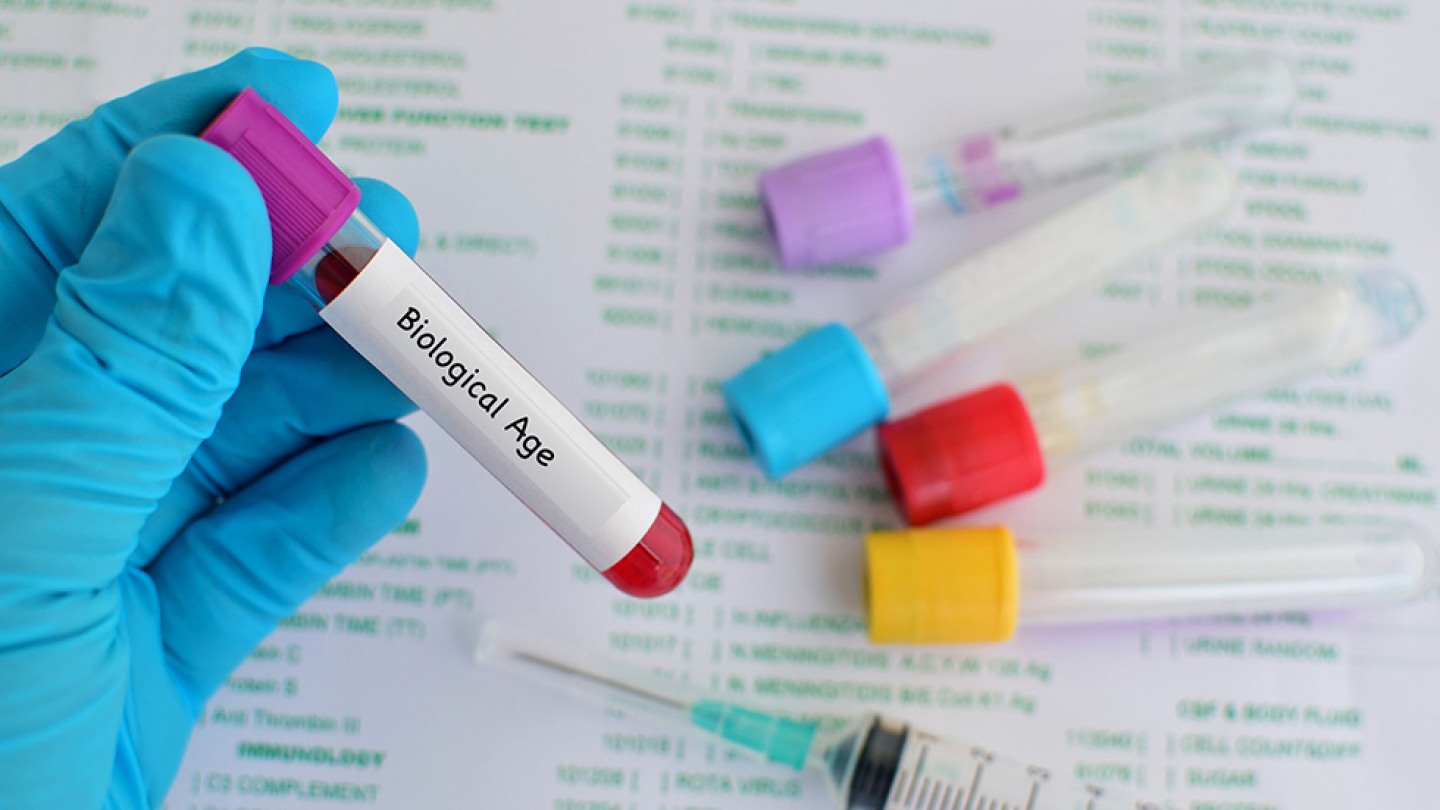 biological age test kit